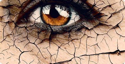 How do I know if I have Dry Eye?